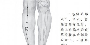 胃溃疡穴位治疗