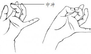 中冲穴:苏厥、开窍、清心第一穴
